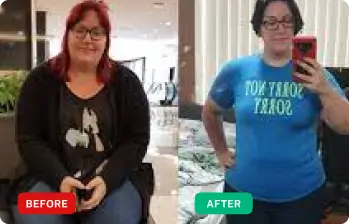 AltBurn Keto Capsules before and after style review photo